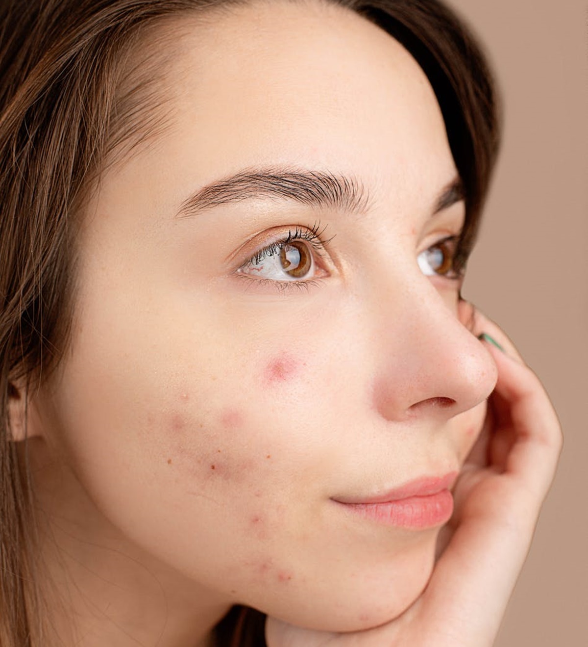 Yüzdeki Sivilceler İçin Evde Kahve Maskesi Yapımı